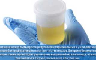 Меняется ли моча при беременности на ранних сроках