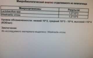 Анализ мочи на посев при беременности что показывает