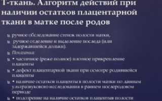 Остатки плацентарной ткани после родов