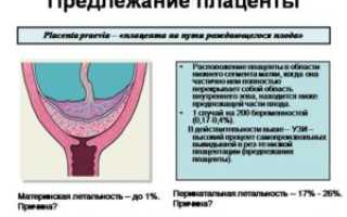 18 недель предлежание плаценты