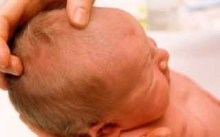 У ребенка не зарастает родничок
